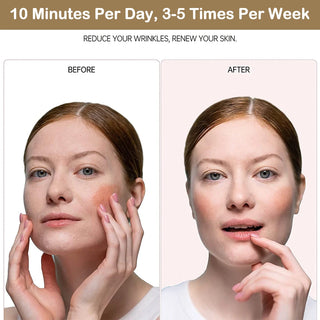 Face Lift Therapy Skin Tightening Device