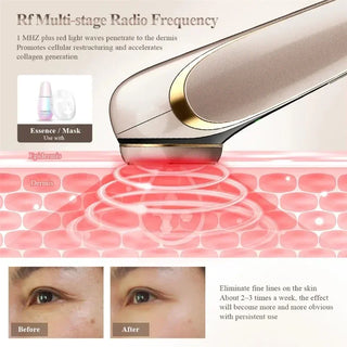 EMS Microcurrent Facial Massager Face Lifting Device Clean and exfoliate Wrinkle Removal Skin Care Beauty Anti-aging