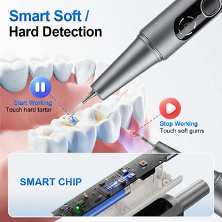 Electric Visual Ultrasonic Dental Scaler