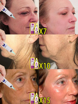 Electronic Portable Beauty Care Equipment