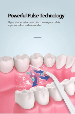 Oral Irrigator Dental Water Jet - Epictzar Intl.