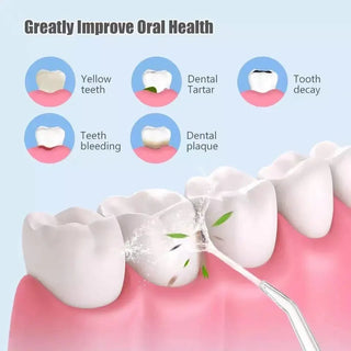 Portable Dental Water Jet Teeth Cleaner - Epictzar Intl.