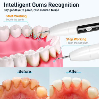 Camera Visual Irrigator Teeth Tartar Eliminator