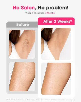 990000 Flash Painless Laser IPL Epilator Women Shaver Permanent Hair Removal For Body Face Bikini Underarm Hair Removal Machine