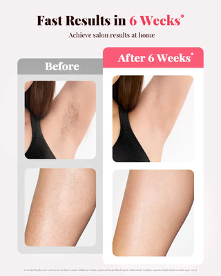Electric IPL Permanent Laser Hair Removal, 999900 Flash Pulses Depilador, Bikini Trimmer, Laser Photoepilator for Women